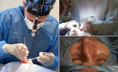 В Обуховской больнице проводят высококвалифицированные ЛОР-операции