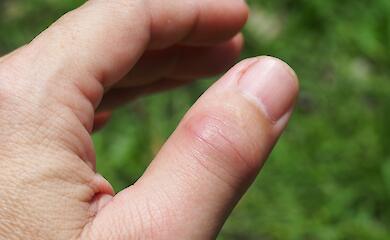 Питание для здоровых суставов: что есть, а чего избегать