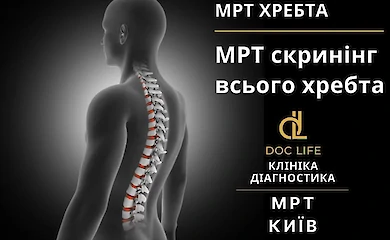 МРТ хребта у Києві та Консультація невропатолога у клініці Doc Life