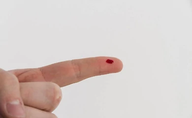 Чи потрібно використовувати антисептики при подряпинах і порізах