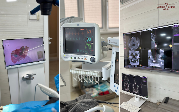 Имплантация одного зуба под ключ в Одессе &mdash; цены, этапы, гарантия