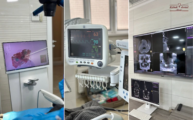 Имплантация одного зуба под ключ в Одессе &mdash; цены, этапы, гарантия