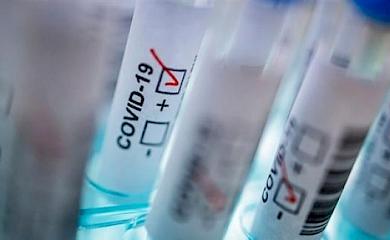 За останню добу в Обухові зафіксували 5 нових випадків COVID-19
