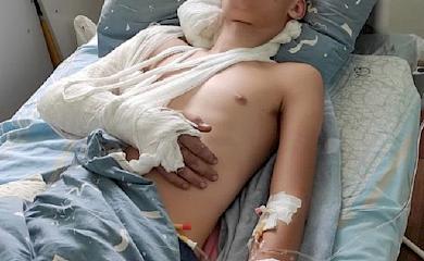 В Обухові травмувався мотоцикліст: батьки шукають свідків ДТП
