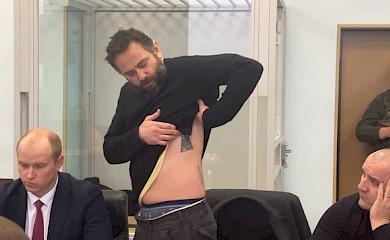 Підозрюваний у держзраді Дубінський заявив в суді, що у нього зламано 2 ребра