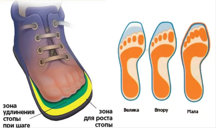 Як вибрати ортопедичне взуття: рекомендації для дітей і дорослих